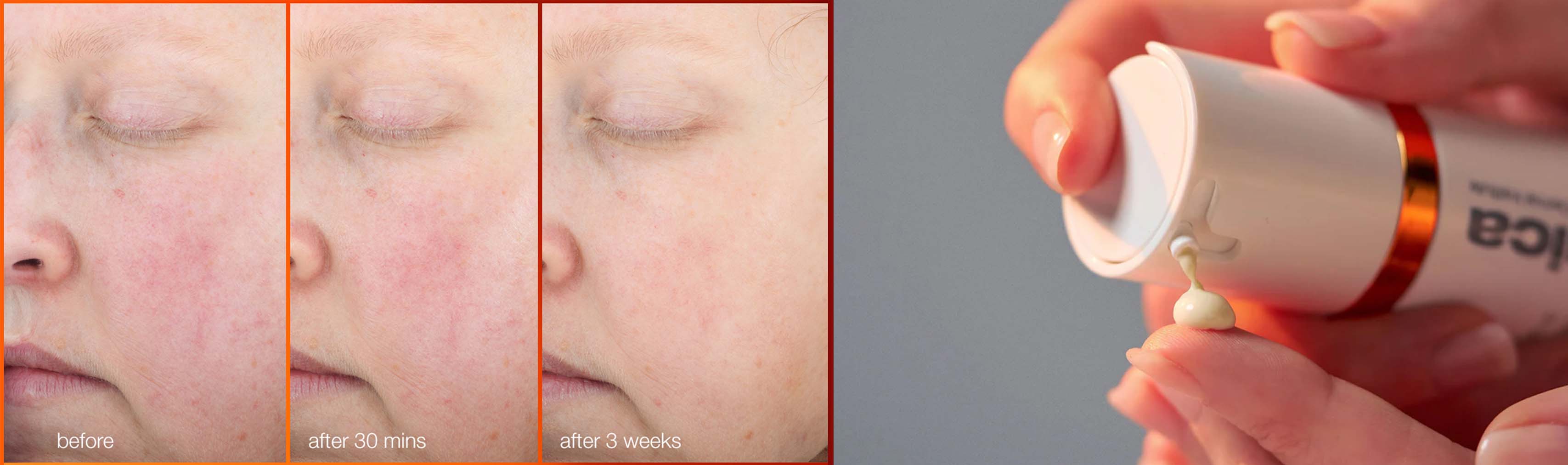 Biolumin-C Heat Aging Protector SPF 50